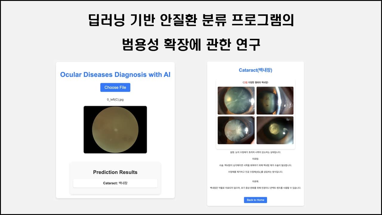 신경망 모델을 활용한 안질환 분류 프로그램